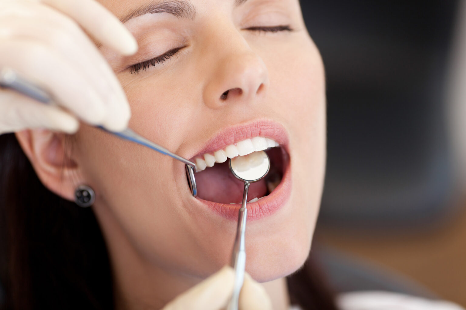 how long can you go between dental cleanings