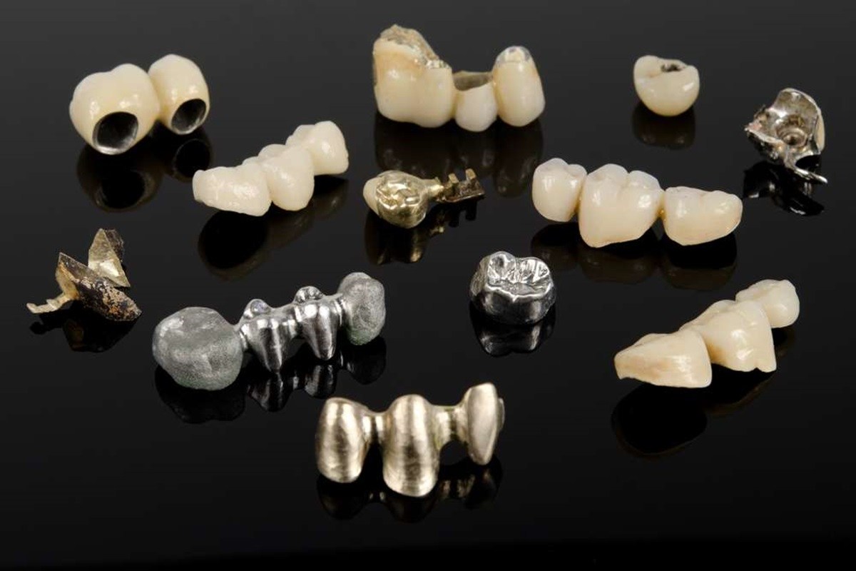 8 benefits you must know before getting cerec crowns